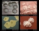 colony morphology